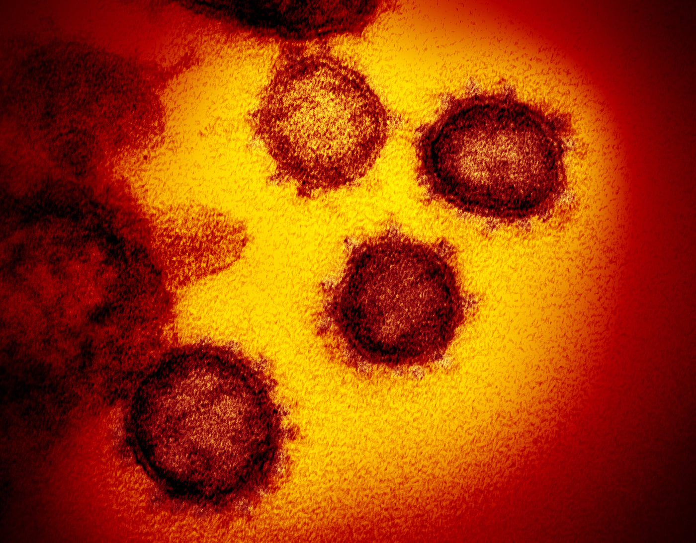 covid 19 virus image at cellular level 