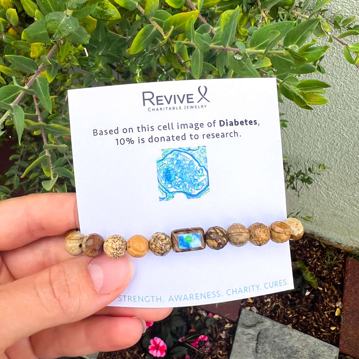 mens bracelet with picture jasper and diabetes cell image in resin pendant on stretch cord on product packaging card